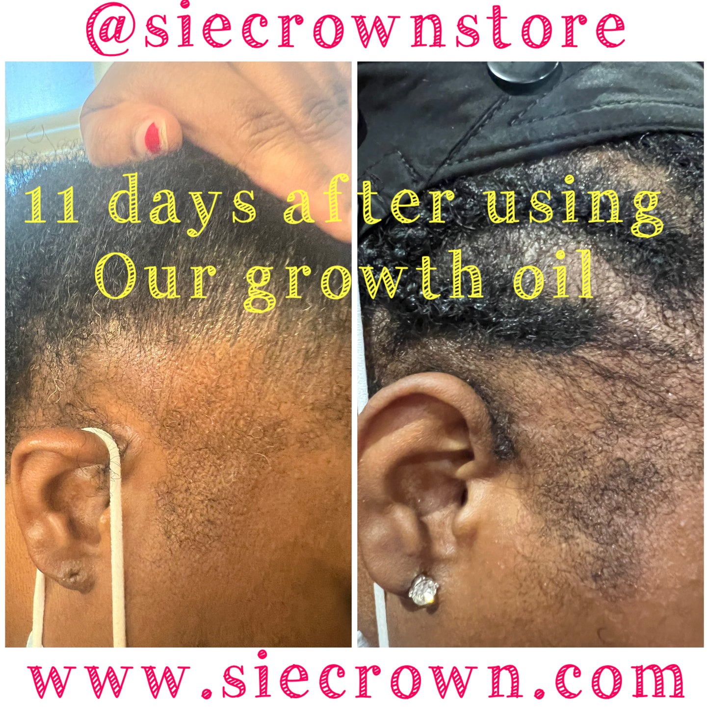 Growth Serum Oil